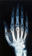 X-Ray